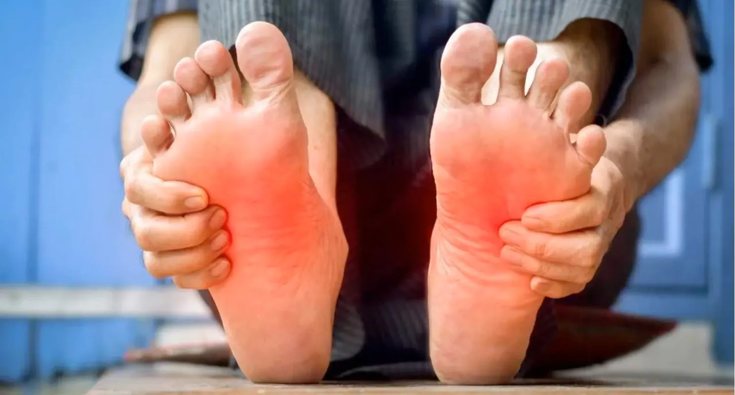 Plantes de pieds avec zones douloureuses marquées